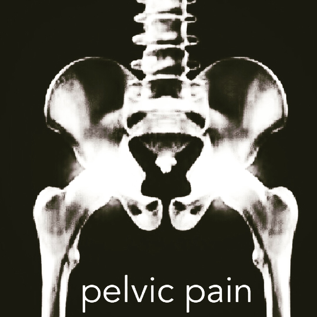 What is pelvic pain ?