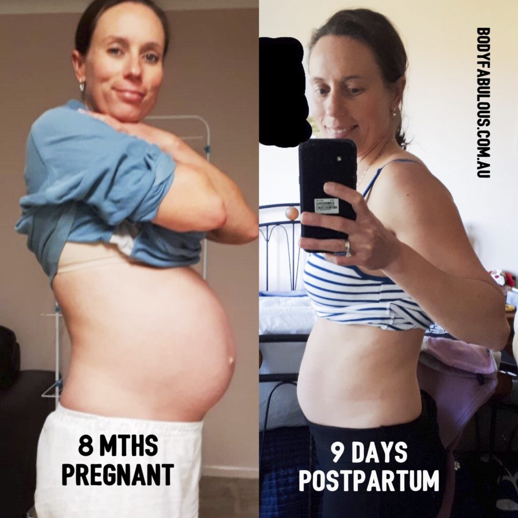 Why a better postpartum recovery starts during pregnancy