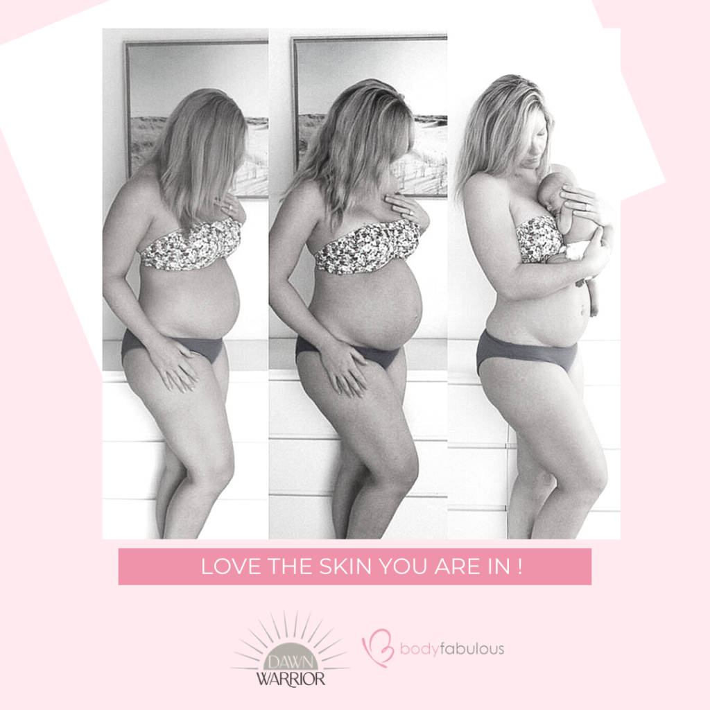 Love the Skin You’re In: Embracing Your Body, Postpartum & Beyond