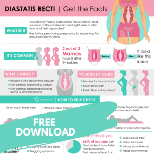 diastasis-recti-infographic-bodyfabulous-fitness-dahlas-trainer